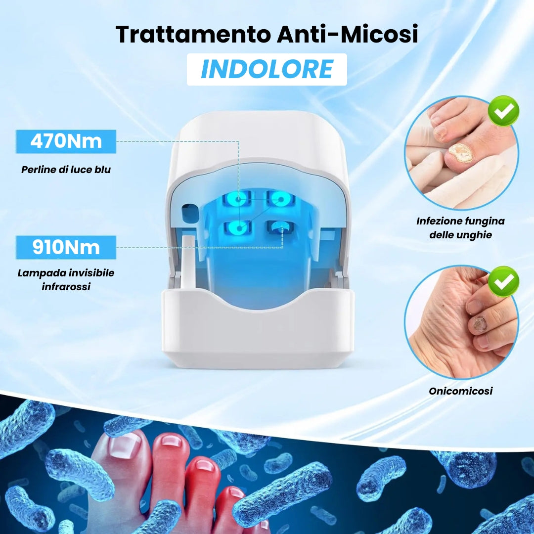 NailRepair Pro™ – Dispositivo Trattamento Laser Micosi delle Unghie