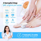 NailRepair Pro™ – Dispositivo Trattamento Laser Micosi delle Unghie